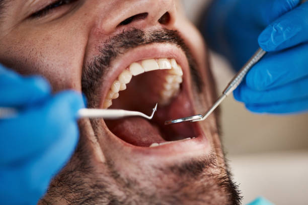 Best Dentist for Tooth Abscess  in Dunthpe, OR